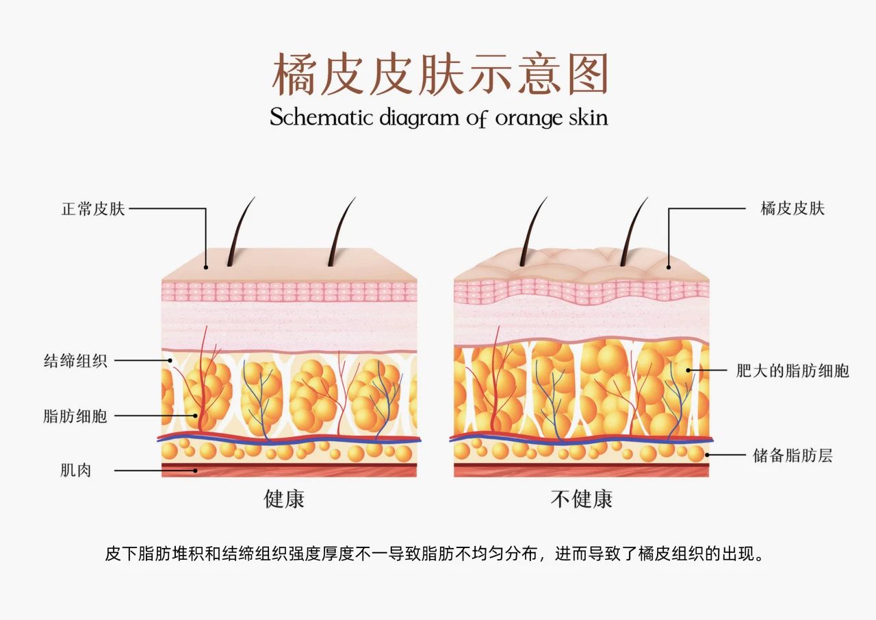 凯时人生就是博重磅引进新型体控原料！(图2)